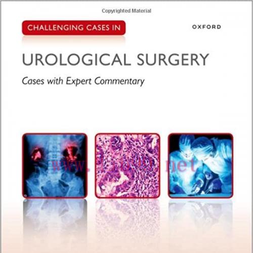 [AME]Challenging Cases in Urological Surgery (Original PDF) 
