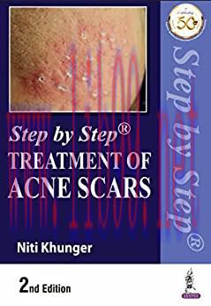 [AME]Step by Step Treatment of Acne Scars, 2nd Edition (Original PDF) 