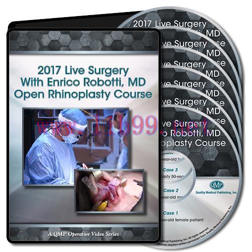 [AME]QMP 2017 Live Surgery With Enrico Robotti Open Rhinoplasty Course (CME VIDEOS) 