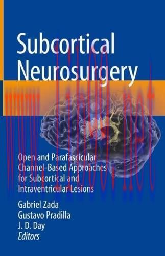 [AME]Subcortical Neurosurgery: Open and Parafascicular Channel-Based Approaches for Subcortical and Intraventricular Lesions (Original PDF) 