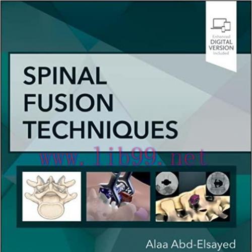 [PDF]Spinal Fusion Techniques