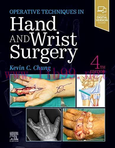[AME]Operative Techniques: Hand and Wrist Surgery, 4th Edition (Videos, Well-organized) 