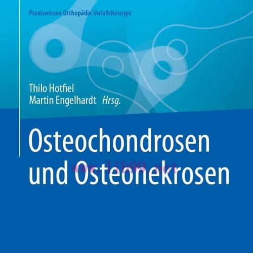 [AME]Osteochondrosen und Osteonekrosen (EPUB) 