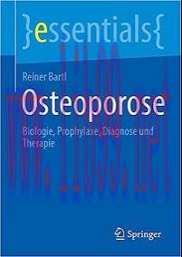 [AME]Osteoporose: Biologie, Prophylaxe, Diagnose und Therapie (essentials) (German Edition) (EPUB) 