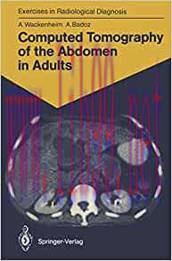 [AME]Computed Tomography of the Abdomen in Adults: 85 Radiological Exercises for Students and Practitioners (Exercises in Radiological Diagnosis) (EPUB) 