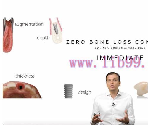 [AME]Zero Bone Loss Concepts, ZBLC Immediate MasterClass - Tomas Linkevicius (Videos) 