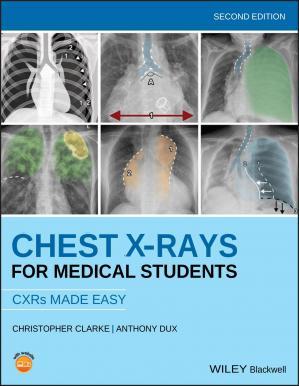 Chest X-Rays for Medical Students 2e 2020