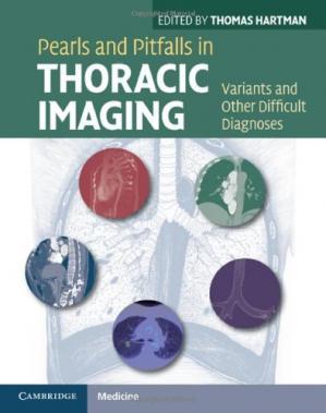 Pearls and Pitfalls in Thoracic Imaging: Variants and Other Difficult Diagnoses 1st Edition