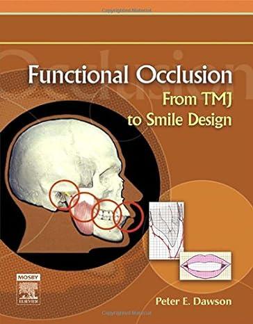 Functional Occlusion From_TMJ to Smile Design 1st Edition