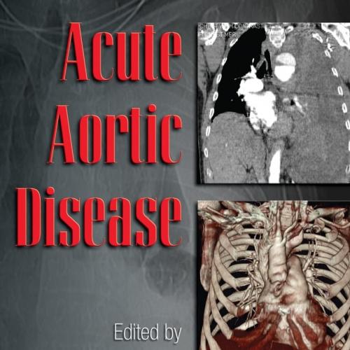 Acute Aortic Disease (Fundamental and Clinical Cardiology) 1st Edition