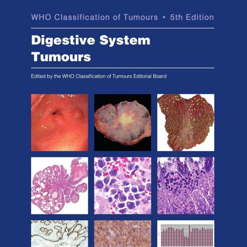 Digestive System Tumours: WHO Classification of Tumours (Medicine) 5th Edition
