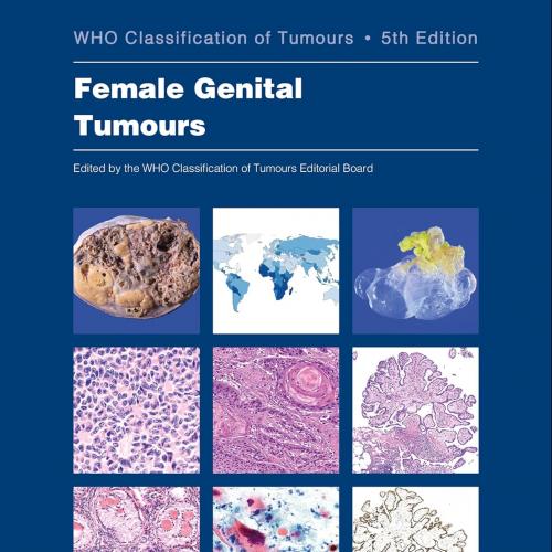 Female Genital Tumours: WHO Classification of Tumours (Medicine) 5th Edition
