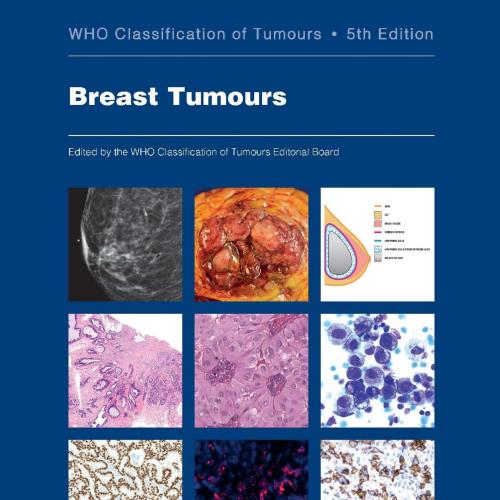 Breast Tumours: WHO Classification of Tumours (Medicine) 5th Edition