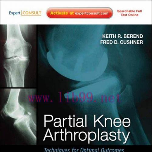[AME]Partial Knee Arthroplasty: Techniques for Optimal Outcomes (Original PDF) 