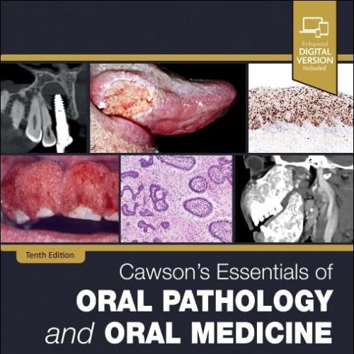 Cawson’s Essentials of Oral Pathology and Oral Medicine 10th Edition
