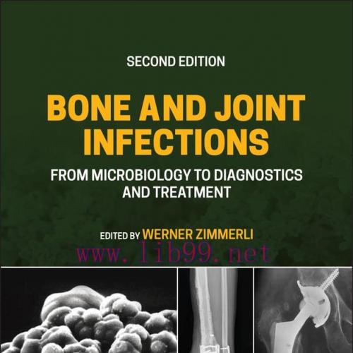 [AME]Bone and Joint Infections: From_ Microbiology to Diagnostics and Treatment, 2nd Edition (EPUB) 