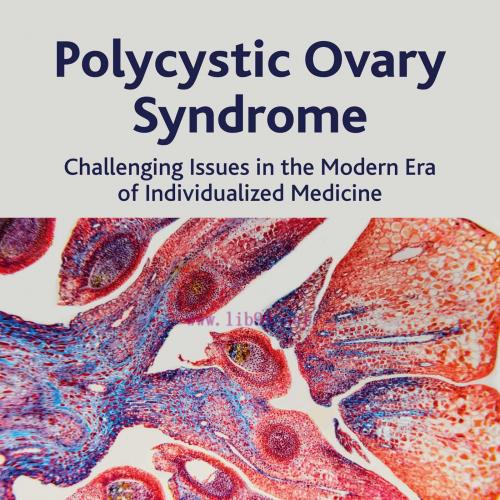 [AME]Polycystic Ovary Syndrome: Challenging Issues in the Modern Era of Individualized Medicine (EPUB) 