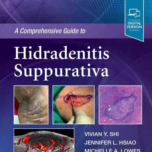[AME]A Comprehensive Guide to Hidradenitis Suppurativa (EPUB) 