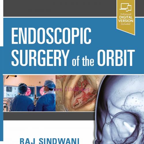 [AME]Endoscopic Surgery of the Orbit (EPUB) 