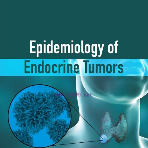 [AME]Epidemiology of Endocrine Tumors (EPUB) 