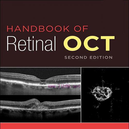 [AME]Handbook of Retinal OCT: Optical Coherence Tomography, 2nd Edition (EPUB) 