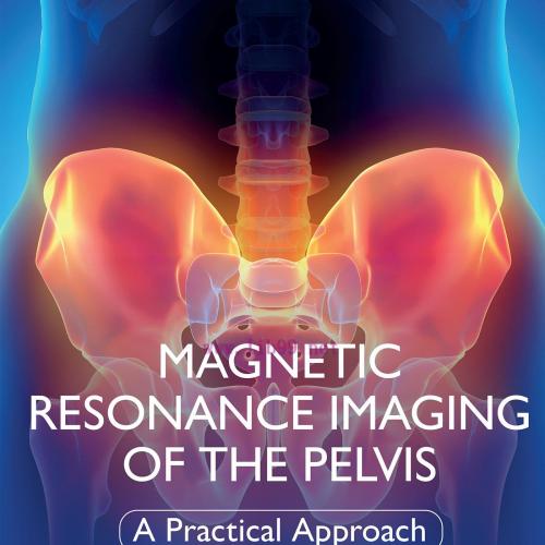 [AME]Magnetic Resonance Imaging of The Pelvis: A Practical Approach (EPUB) 