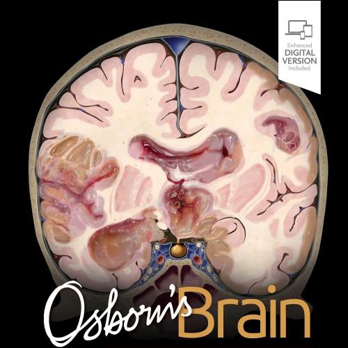[AME]Osborn’s Brain, 3rd Edition (EPub+Converted PDF)