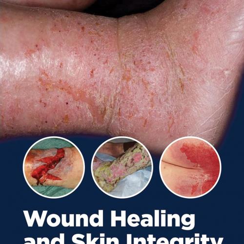 Wound Healing and Skin Integrity Principles and Practice 1st Edition