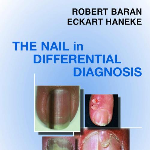 Nail in Differential Diagnosis 1st Edition