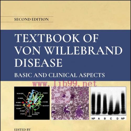[AME]Textbook of Von Willebrand Disease, 2nd Edition (Original PDF) 