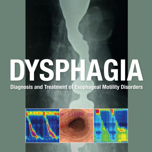 [AME]Dysphagia: Diagnosis and Treatment of Esophageal Motility Disorders (Original PDF) 