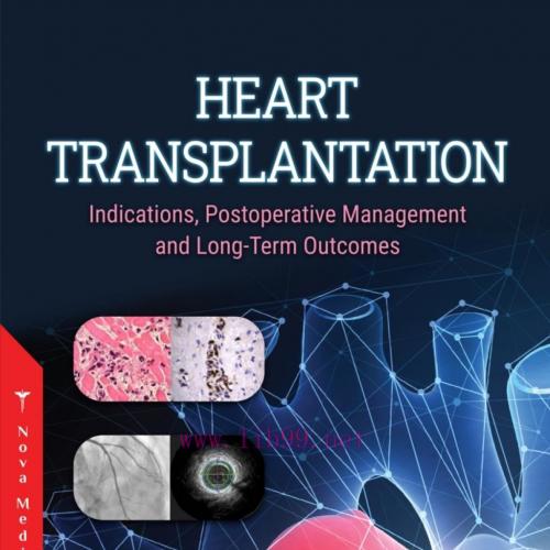 [AME]Heart Transplantation: Indications, Postoperative Management and Long-Term Outcomes (Original PDF) 