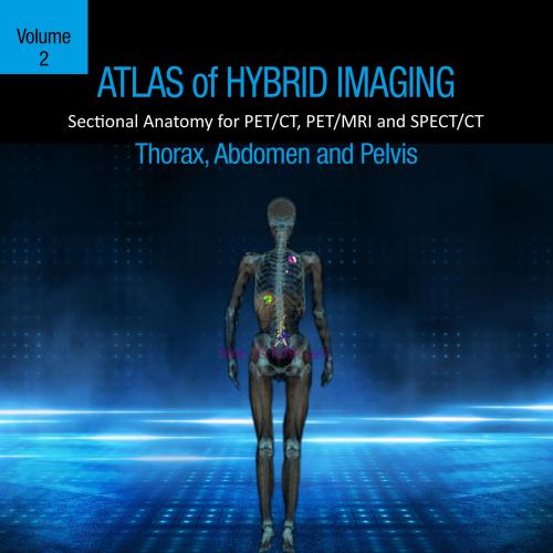 [AME]Atlas of Hybrid Imaging Sectional Anatomy for PET/CT, PET/MRI and SPECT/CT Vol. 2: Thorax Abdomen and Pelvis: Sectional Anatomy for PET/CT, PET/MRI and SPECT/CT (EPUB) 