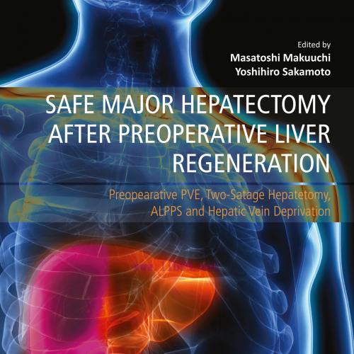 [AME]Safe Major Hepatectomy after Preoperative Liver Regeneration: Preopearative PVE, Two-Satage Hepatetomy, ALPPS and Hepatic Vein Deprivation (Original PDF) 