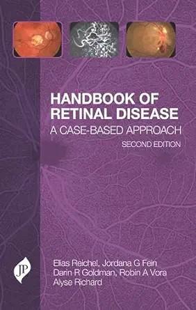 [AME]Handbook of Retinal Disease: A Case- Based Approach, 2ed (Original PDF) 