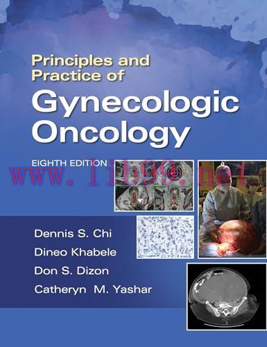 [AME]Principles and Practice of Gynecologic Oncology, 8th Edition (EPUB) 