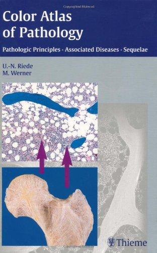 Color Atlas of Pathology Pathologic Principles-Associated Diseases-Sequela 1st Edition