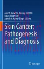 [PDF]Skin Cancer: Pathogenesis and Diagnosis
