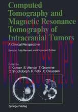 [PDF]Computed Tomography and Magnetic Resonance Tomography of Intracranial Tumors: A Clinical Perspective