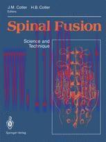 [PDF]Spinal Fusion: Science and Technique