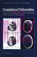 [PDF]Craniofacial Deformities: Atlas of Three-Dimensional Reconstruction from_ Computed Tomography