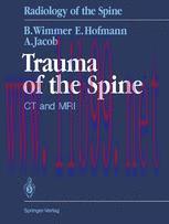 [PDF]Trauma of the Spine: CT and MRI