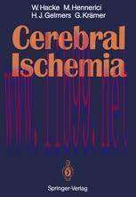 [PDF]Cerebral Ischemia