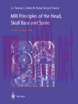 [PDF]MRI Principles of the Head, Skull Base and Spine: A Clinical Approach