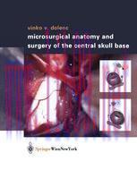 [PDF]Microsurgical Anatomy and Surgery of the Central Skull Base