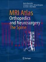 [PDF]MRI Atlas: Orthopedics and Neurosurgery, The Spine