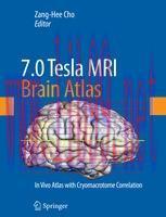 [PDF]7.0 Tesla MRI Brain Atlas: In Vivo Atlas with Cryomacrotome Correlation