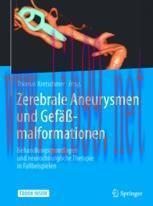[PDF]Zerebrale Aneurysmen und Gefäßmalformationen: Behandlungsgrundlagen und neurochirurgische Therapie in Fallbeispielen