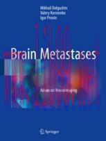 [PDF]Brain Metastases: Advanced Neuroimaging