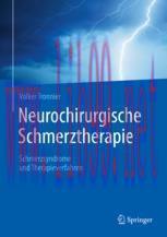 [PDF]Neurochirurgische Schmerztherapie: Schmerzsyndrome und Therapieverfahren